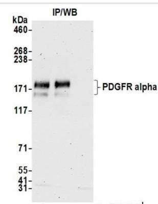 Immunoprecipitation: PDGFR alpha Antibody (BLR128H) [NBP3-14711]