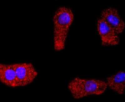 Immunocytochemistry/ Immunofluorescence: PDGFR alpha Antibody (JF104-6) [NBP2-67025]