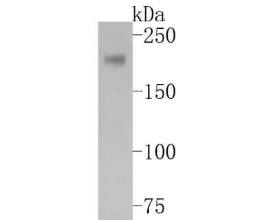 Western Blot: PDGFR alpha Antibody (JF104-6) [NBP2-67025]