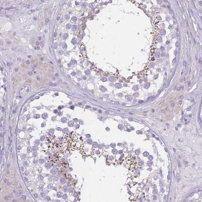 Immunohistochemistry: PDHA2 Antibody [NBP2-32054]