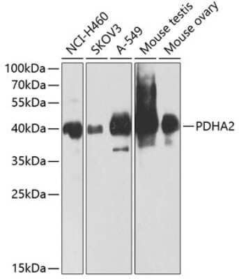 Western Blot: PDHA2 AntibodyBSA Free [NBP2-94194]
