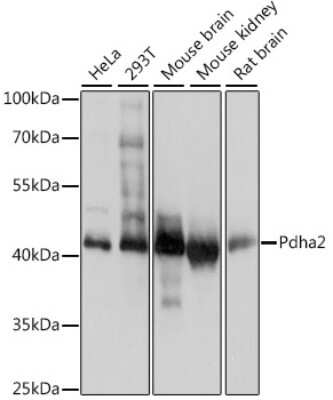 Western Blot: PDHA2 AntibodyAzide and BSA Free [NBP2-95157]