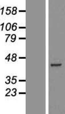 Western Blot: PDHA2 Overexpression Lysate [NBL1-14242]