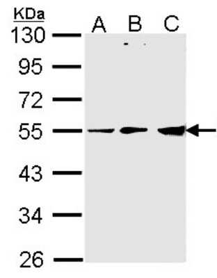 Western Blot: PDHX Antibody [NBP2-19749]