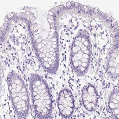 Immunohistochemistry-Paraffin: PDIA2 Antibody [NBP2-49015]