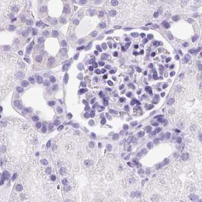 Immunohistochemistry-Paraffin: PDIA2 Antibody [NBP2-49086]