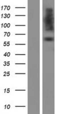 Western Blot: PDIA2 Overexpression Lysate [NBP2-10396]