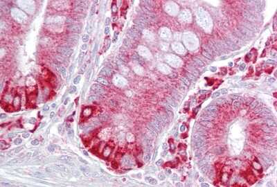 Immunohistochemistry-Paraffin: PDIA6 Antibody [NBP1-57968]
