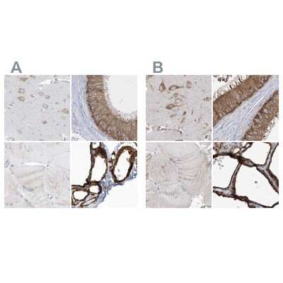 Immunohistochemistry-Paraffin: PDIA6 Antibody [NBP2-38213]