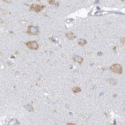 Immunohistochemistry-Paraffin: PDIA6 Antibody [NBP2-38213]