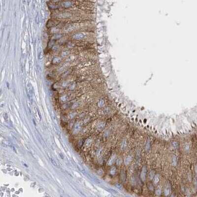 Immunohistochemistry-Paraffin: PDIA6 Antibody [NBP2-38213]