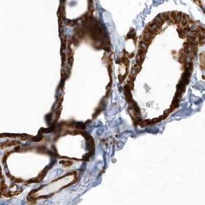 Immunohistochemistry-Paraffin: PDIA6 Antibody [NBP2-38213]