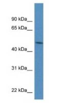 Western Blot: PDIA6 Antibody [NBP1-57999]