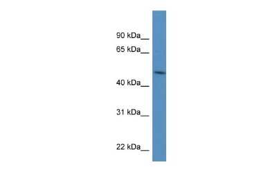 Western Blot: PDIA6 Antibody [NBP1-57999]