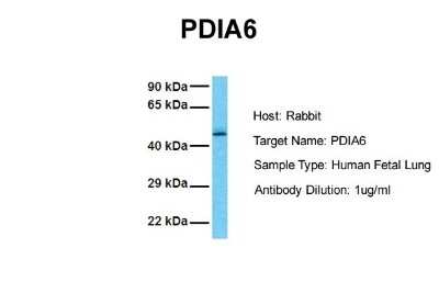 Western Blot: PDIA6 Antibody [NBP1-57999]