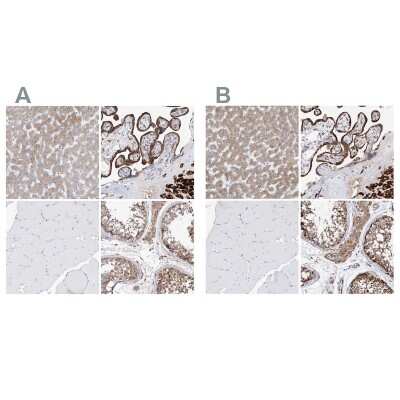Immunohistochemistry-Paraffin: PDIR Antibody [NBP1-92250]