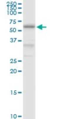 Western Blot: PDIR Antibody [H00010954-D01P]
