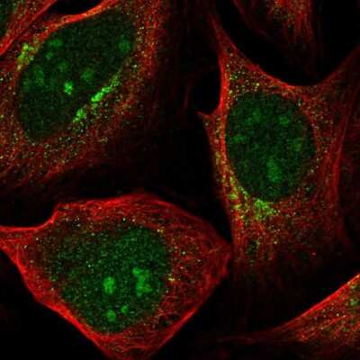 Immunocytochemistry/ Immunofluorescence: Pyruvate Dehydrogenase Kinase 1/PDK1 Antibody [NBP2-56835]