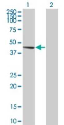 Western Blot: PDK2 Antibody (2D12) [H00005164-M03]