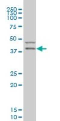 Western Blot: PDK2 Antibody (2G1) [H00005164-M01]
