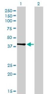 Western Blot: PDK2 Antibody (2G1) [H00005164-M01]
