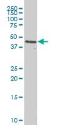 Western Blot: PDK2 Antibody (5F8) [H00005164-M02]