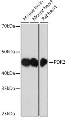 Western Blot: PDK2 Antibody (7X6R7) [NBP3-16314]
