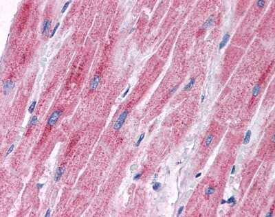 Immunohistochemistry-Paraffin: PDK2 Antibody [NBP1-54699]