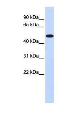 Western Blot: PDK2 Antibody [NBP1-54699]