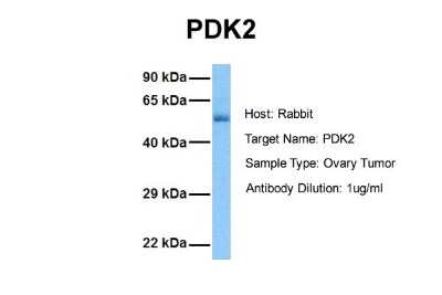Western Blot: PDK2 Antibody [NBP1-54699]