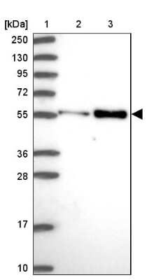 Western Blot: PDK3 Antibody [NBP2-13745]