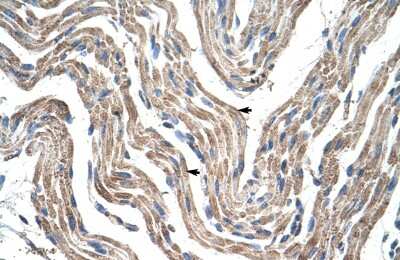 Immunohistochemistry-Paraffin: PDK4 Antibody [NBP1-54723]