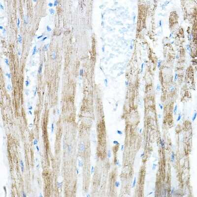 Immunohistochemistry-Paraffin: PDK4 Antibody - Azide and BSA Free [NBP2-93829]