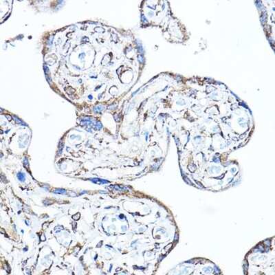 Immunohistochemistry-Paraffin: PDK4 Antibody - Azide and BSA Free [NBP2-93829]