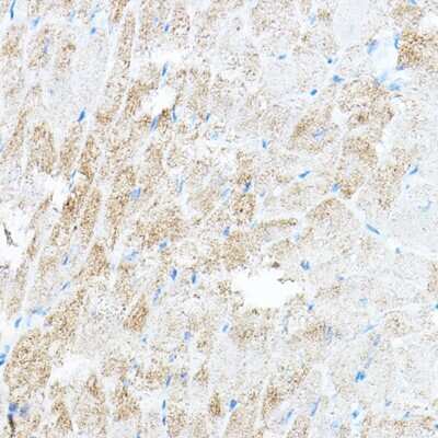 Immunohistochemistry-Paraffin: PDK4 Antibody - Azide and BSA Free [NBP2-93829]