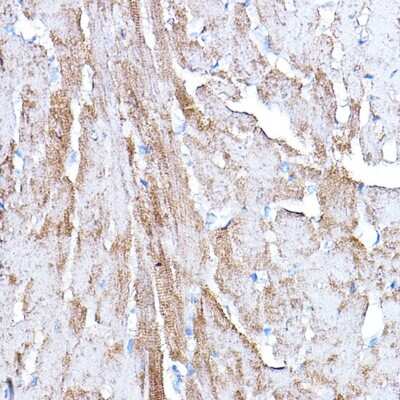 Immunohistochemistry-Paraffin: PDK4 Antibody - Azide and BSA Free [NBP2-95194]