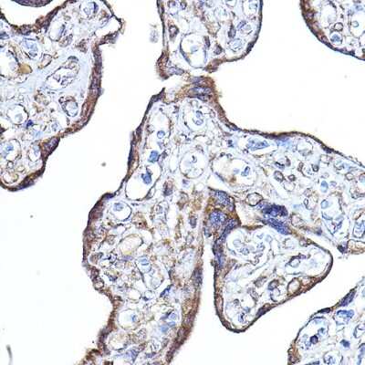 Immunohistochemistry-Paraffin: PDK4 Antibody - Azide and BSA Free [NBP2-95194]
