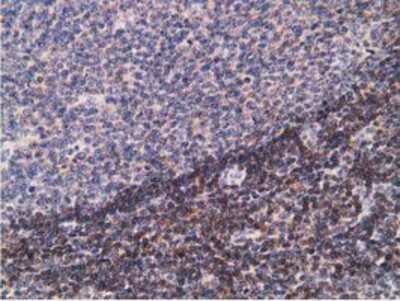 Immunohistochemistry-Paraffin: PDLIM2 Antibody (OTI11A12) [NBP2-00619]