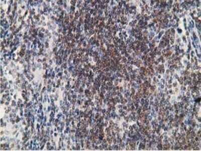 Immunohistochemistry: PDLIM2 Antibody (OTI11A12) - Azide and BSA Free [NBP2-73311]