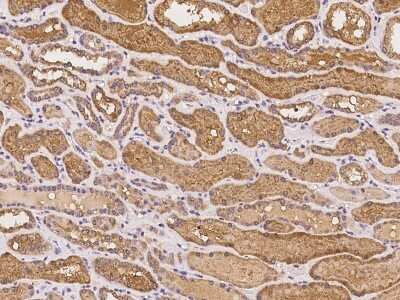 Immunohistochemistry-Paraffin: PDLIM4 Antibody [NBP2-98063]