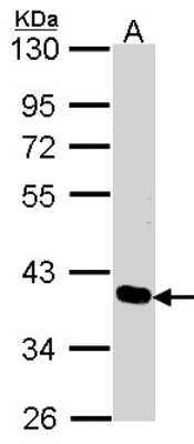 Western Blot: PDLIM4 Antibody [NBP2-19759]