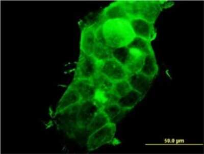 Immunocytochemistry/ Immunofluorescence: PDLIM5 Antibody (3E11-F6) [H00010611-M01]