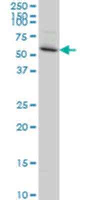 Western Blot: PDLIM5 Antibody (3E11-F6) [H00010611-M01]