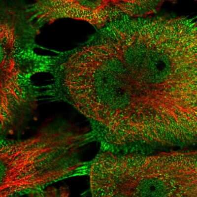 Immunocytochemistry/ Immunofluorescence: PDLIM5 Antibody [NBP1-84842]