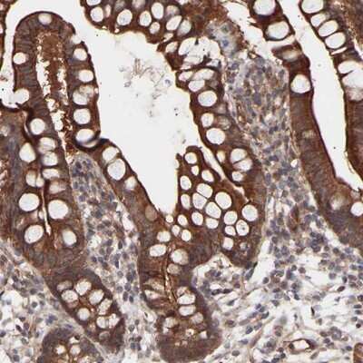 Immunohistochemistry-Paraffin: PDLIM5 Antibody [NBP1-84842]