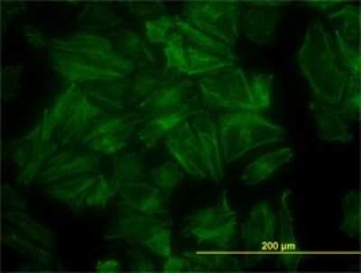 Immunocytochemistry/ Immunofluorescence: PDLIM7 Antibody (2D6) [H00009260-M01]