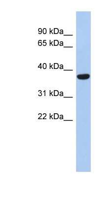 Western Blot: PDP1/PPAPDC2 Antibody [NBP1-60021]