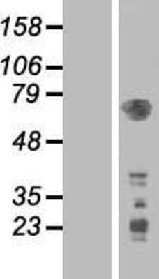 Western Blot: PDK-1 Overexpression Lysate [NBL1-14259]