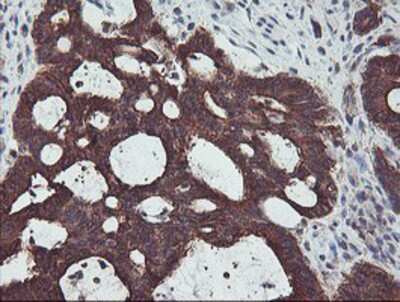 Immunohistochemistry-Paraffin: PDRG1 Antibody (OTI4F12) [NBP2-01854]