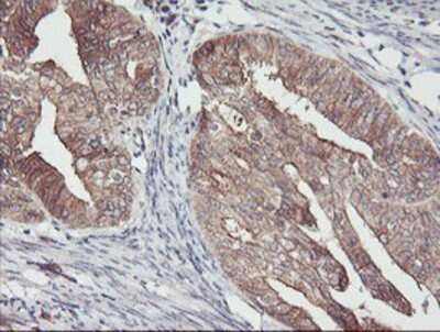 Immunohistochemistry-Paraffin: PDRG1 Antibody (OTI4F12) [NBP2-01854]